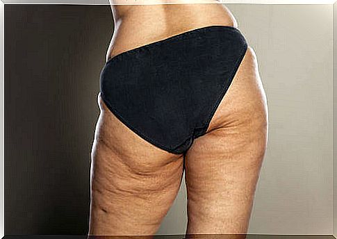 Discover our diet to reduce cellulite