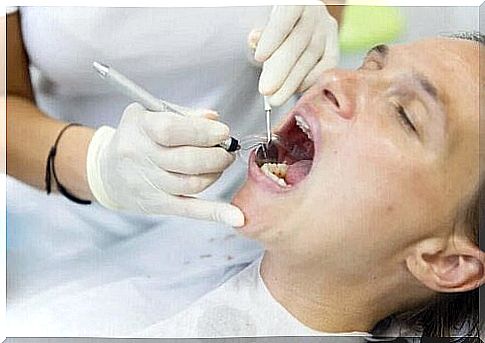 A patient having dental veneers.